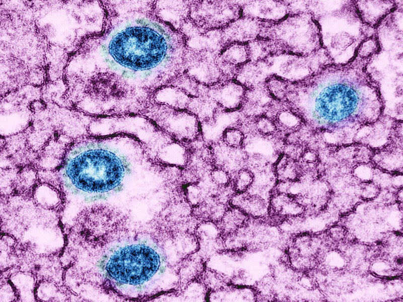 Cell infected with Omicron variant coronavirus, TEM.