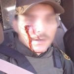 Another border patrol agent wounded
