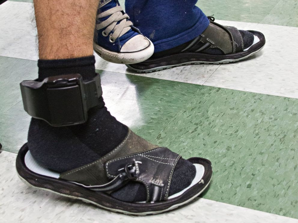 PHOTO: Javier Flores Garcias ankle bracelet allows Immigration and Customs Enforcement (ICE) to know where he is at all times.