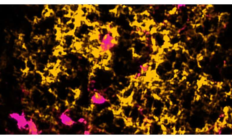 Overcoming obstacles to promote repair in multiple sclerosis