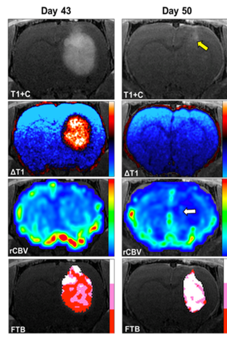 Advanced MRI