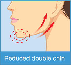 Reduced chin