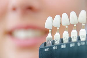 Different shades of teeth