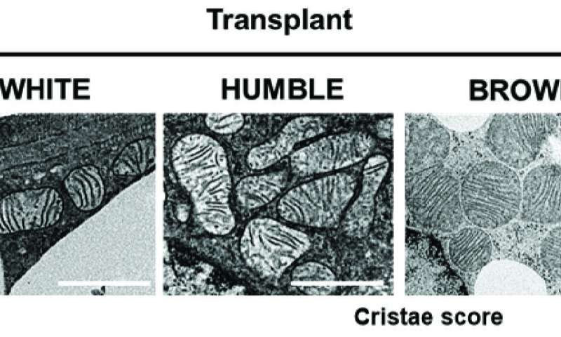 Transplanted brown-fat-like cells hold promise for obesity and diabetes