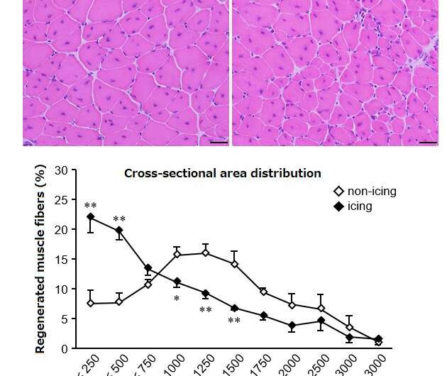 Icing muscle injuries may delay recovery