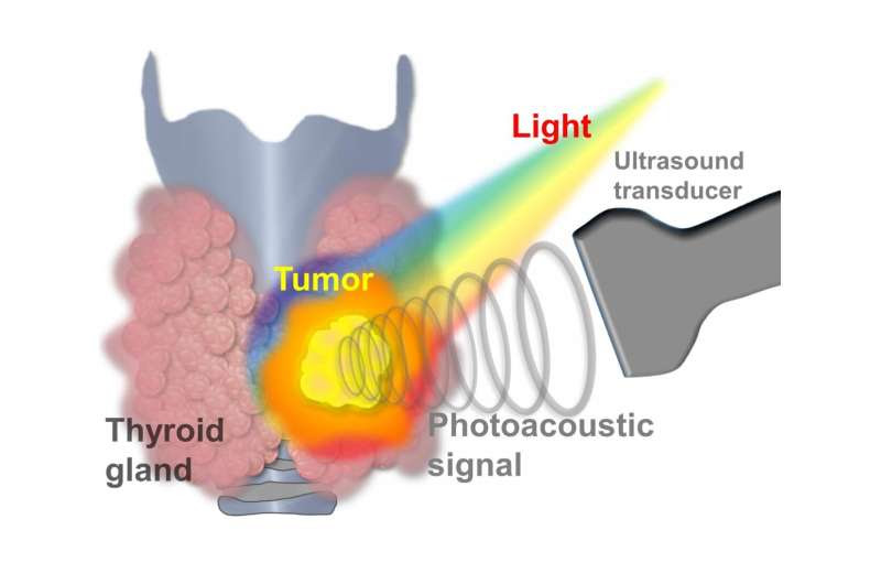 Thyroid cancer now diagnosed with machine learning-powered photoacoustic/ultrasound imaging