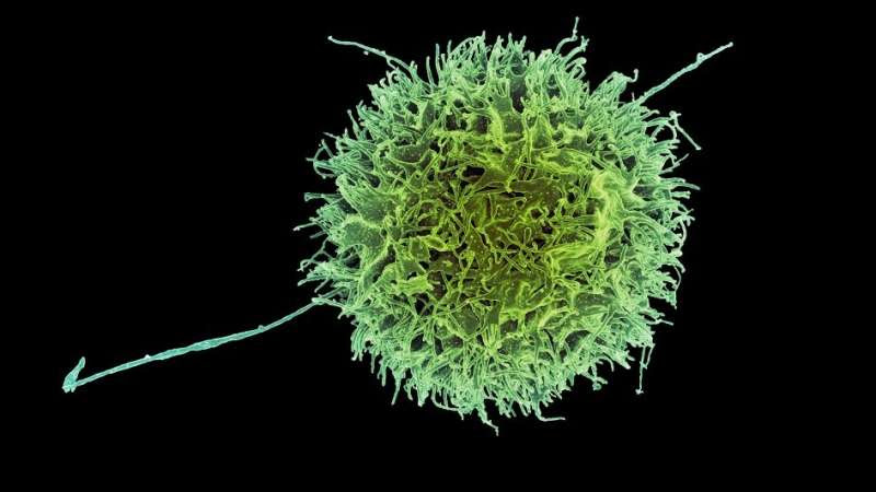 New 'killer' immunotherapy shows early promise in range of solid tumours