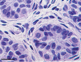 Germ cells in testicular tissues