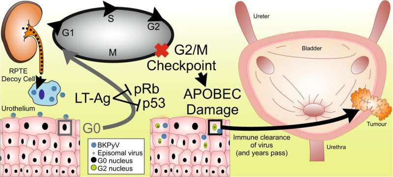 Study: Common virus may cause bladder cancer