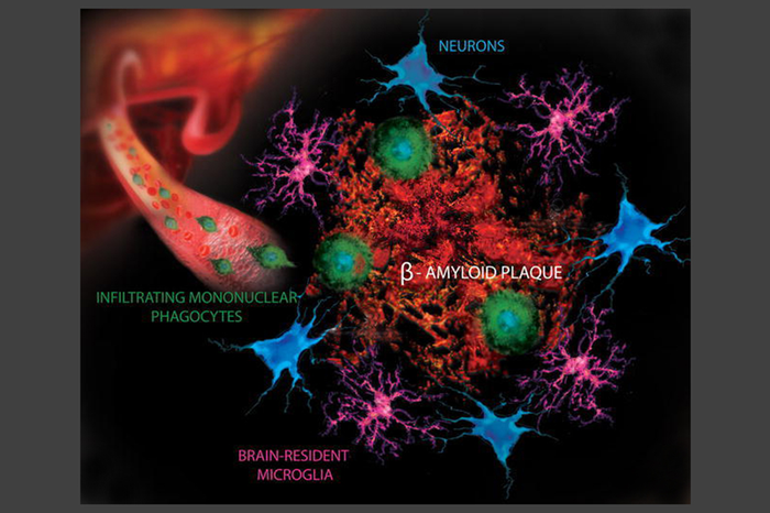 Key Players in Alzheimer's disease.