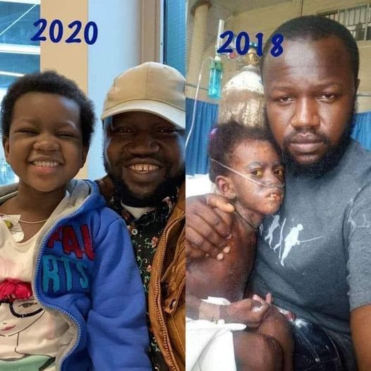 Amazing transformation of 5-year-old Nigerian girl who beat cancer of the blood