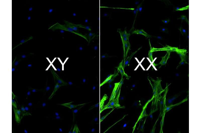 The sex of your cells matters when it comes to heart disease