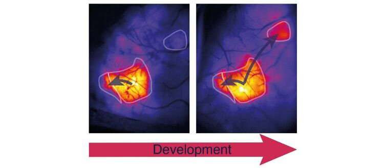 Brain connections have their own tempo - Communiqués de presse