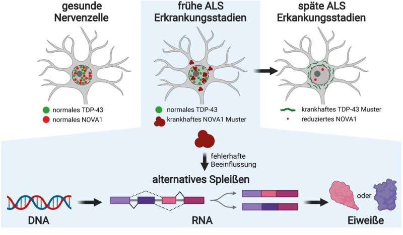 ALS: Early disease mechanisms discovered