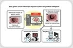 Researchers use AI to develop early gastric cancer endoscopic diagnosis system