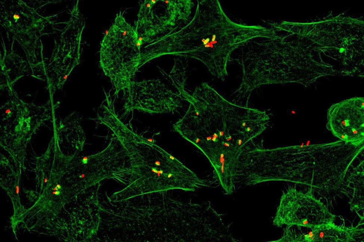 A new study has shed light on the interplay between bacteria (seen here in red), diet and the immune system.