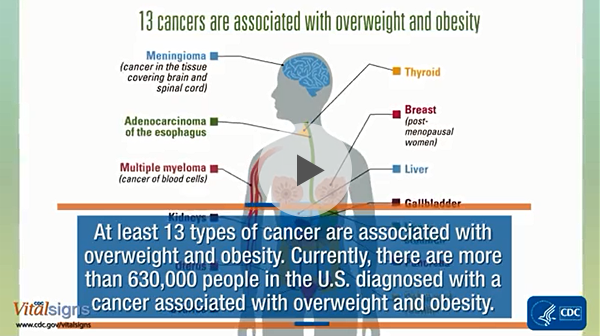 Cancer and obesity