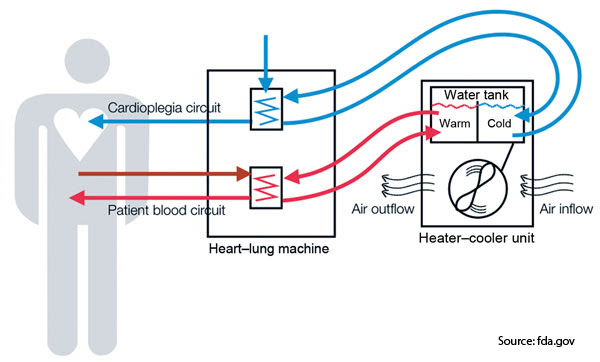 diagram of heater cooler device