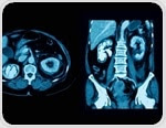 Tests for Ureteric Calculi: Radiograph, CT and Ultrasound