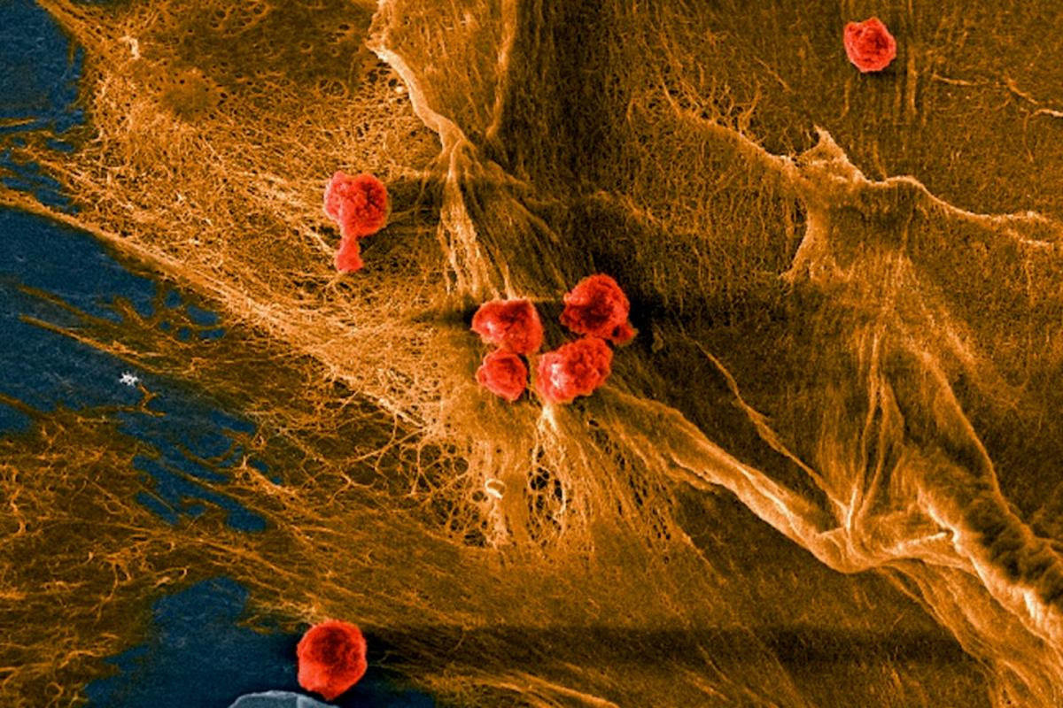 A microscope image of the material, showing natural collagen-forming cells (red) that could reproduce within the interconnected collagen fibers (gold)