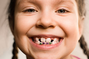 Little girl smiling with braces