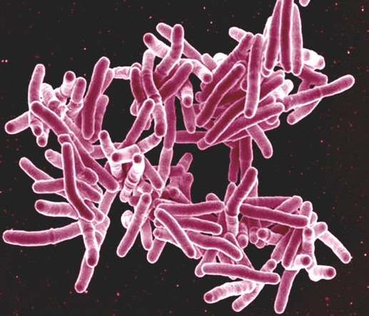 TB bacteria