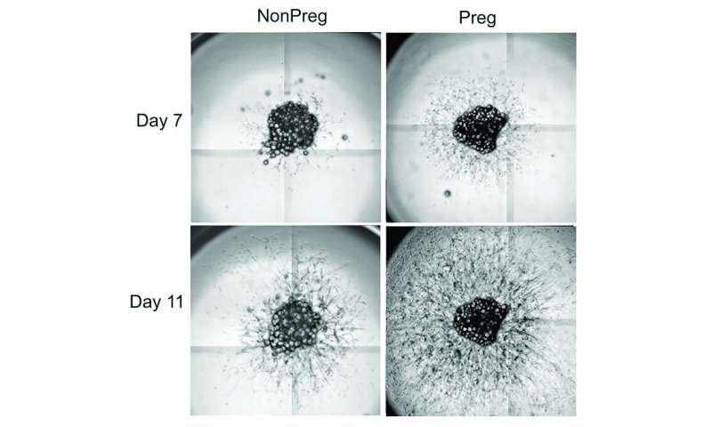 Protein commonly screened for in pregnancy is linked to gestational diabetes