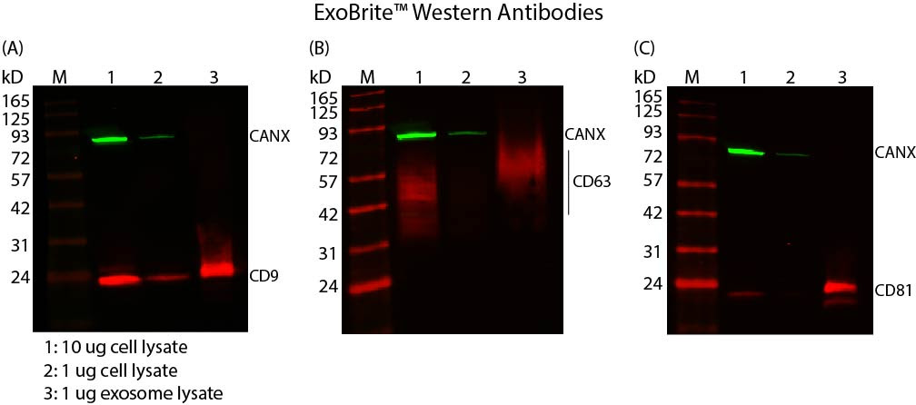 Figure 2. Western detection using ExoBrite™ Western Antibodies and MCF-7 cell and exosome lysates, showing tetraspanin protein enrichment and calnexin depletion in exosomes. Blots were stained with ExoBrite™ 770/800 Calnexin Antibody (exosome negative control) plus (A) ExoBrite™ 680/700 CD9 Antibody, (B) ExoBrite™ 680/700 CD63 Antibody, or (C) ExoBrite™ 680/700 CD81 Antibody. Lane M: Protein marker. Lane 1: 10 ug
cell lysate. Lane 2: 1 ug cell lysate. Lane 3: 1 ug exosome lysate. The blots were imaged on a LI-COR Odyssey® infrared imaging system.
