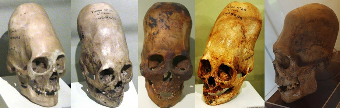 Paracas Elongated Skull’s DNA Results Are In—LA Marzulli Drops a Shocking Report...
