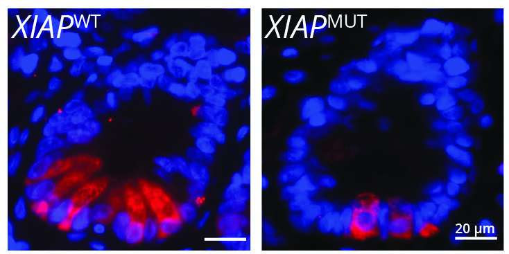 Researchers identify pathway critical for the development and prevention of intestinal inflammation