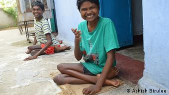Children with deformities (photo: Ashish Birulee)