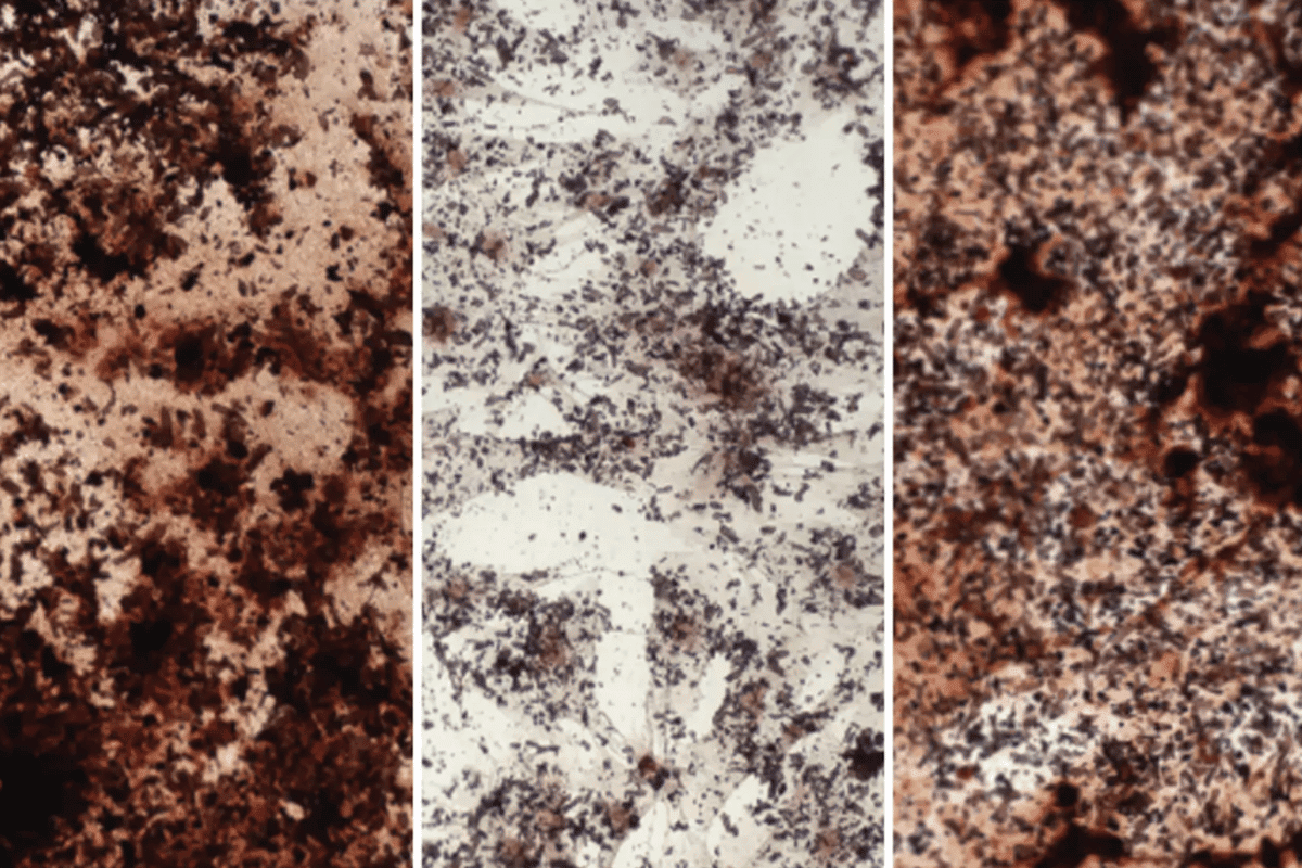 Young stem cells (left) produce more material (dark brown) for bone than old stem cells (center), and a new study shows how they can be rejuvenated by adding sodium acetate (right)