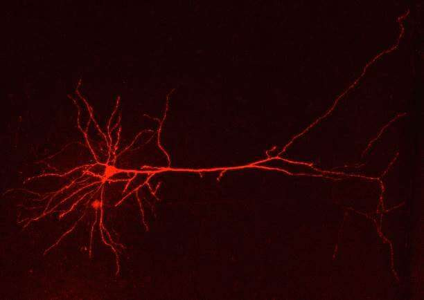 Genetic malfunction of brain astrocytes triggers migraine