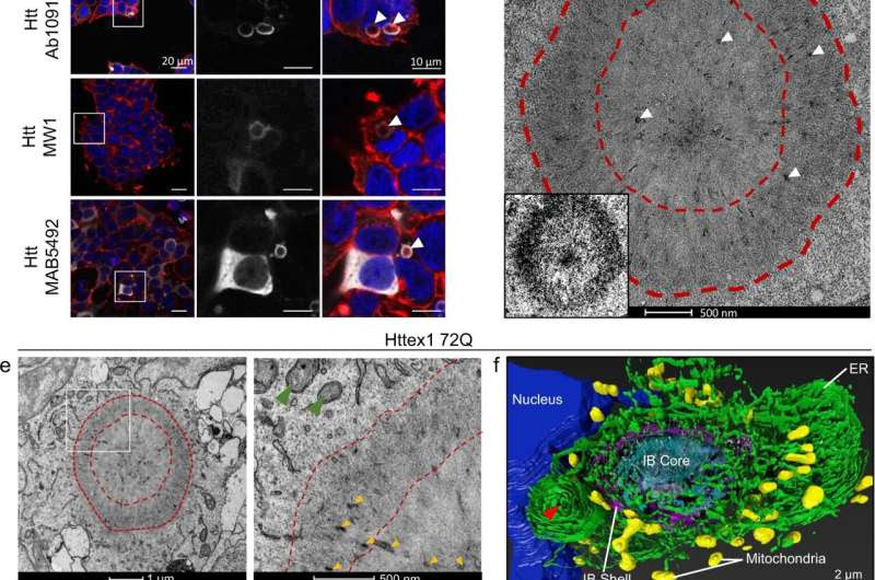 The ultrastructure of huntingtin inclusions revealed