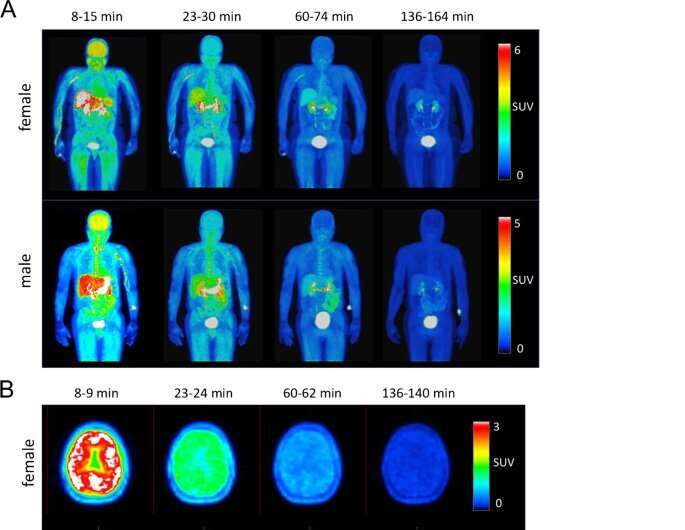 Radiotracer that detects important contributor to neurological diseases is tested for the first time in humans