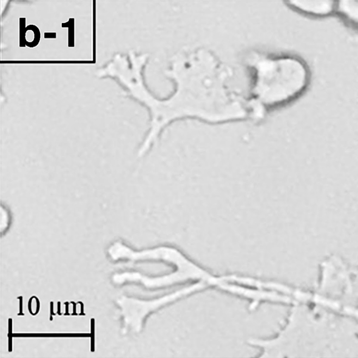 Trophozoite form of Balamuthia mandrillaris in Salmonella Shigella (SS) Agar,