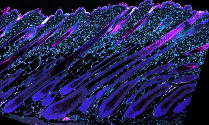 Fine-tuning stem cell metabolism prevents hair loss