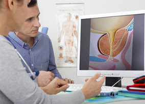 Hiperplasia benigna de próstata, cómo tratar sus síntomas 