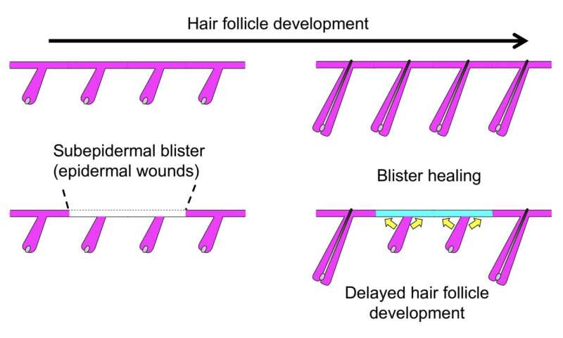 Hair follicles heal blisters at personal cost