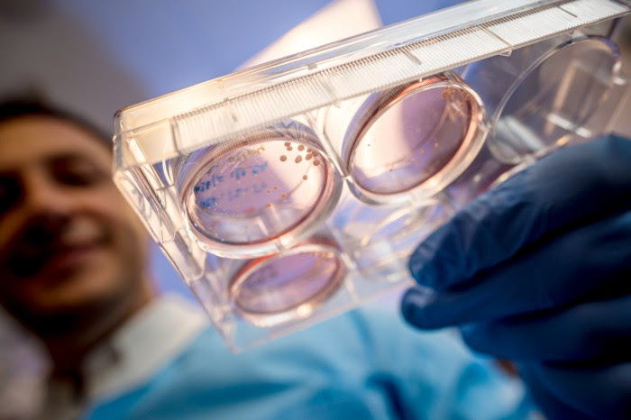 View through the bottom of a laboratory dish being held by a scientist containing brain organoids seen as small white dots