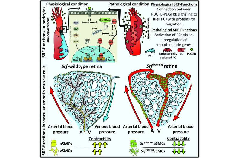 When smooth muscle cells lack strength