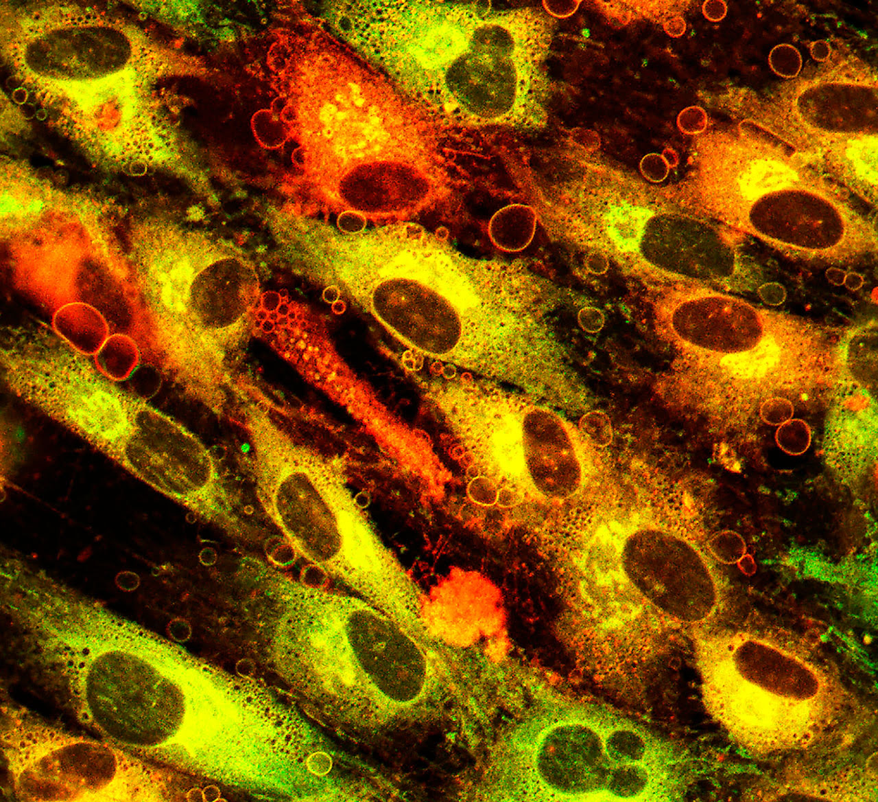 Imagem de micrografia de células da pele.  Além das membranas celulares, complexos de Golgi e núcleos, existem grupos de moléculas menores semelhantes a bolhas.