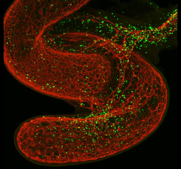 The second brain and innate lymphocytes. Neuronal cells, Innate lymphoid cells