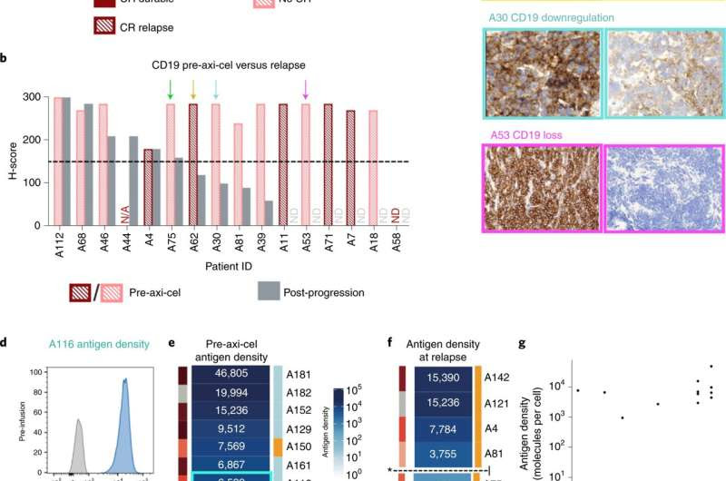 Study predicts who may benefit from CAR-T cell therapy for blood cancers