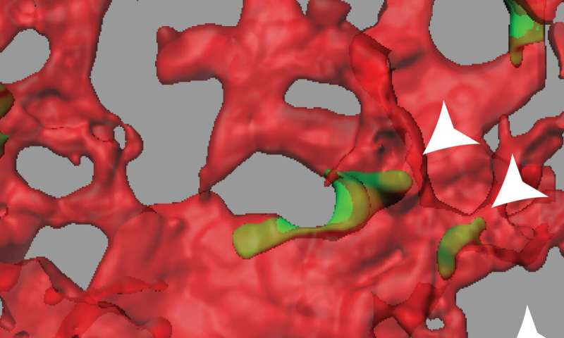 Protein appears to prevent tumor cells from spreading via blood vessels