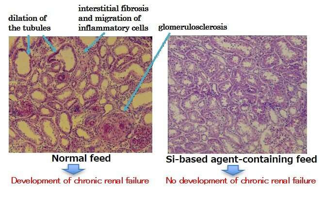 Antioxidant agent may prevent chronic kidney disease and Parkinson's disease