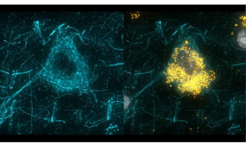 An ultra detailed map of the brain region that controls movement, from mice to monkeys to humans