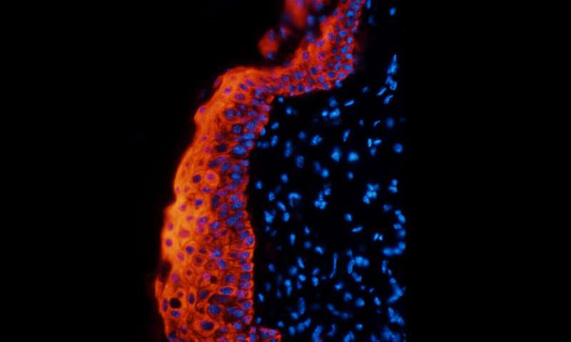 Potential new target to combat inflammatory diseases