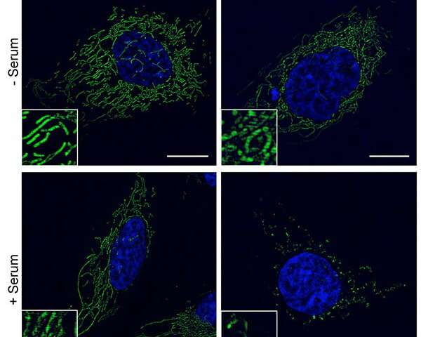 For ME/CFS patients, viral immunities come at a devastating, lifelong cost