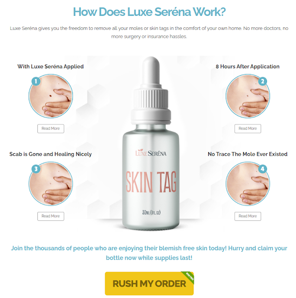 Why Does Luxe Seréna Skin Tag Remover a Game-Changer in the USA? · Customer  Self-Service